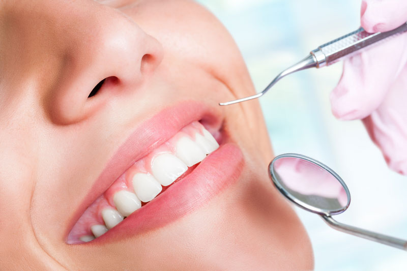 Teeth Cleaning